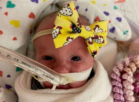 This Baby Was Diagnosed With Trisomy 18 But Her Mother Refused