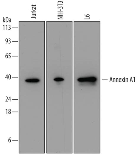 Humanmouserat Annexin A1 Antibody R D Systems 100ug Unlabeled