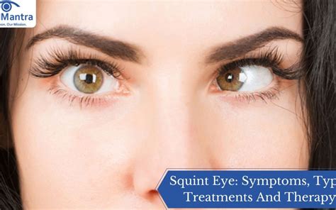 Squint Eye: Symptoms, Types, Treatments And Therapy