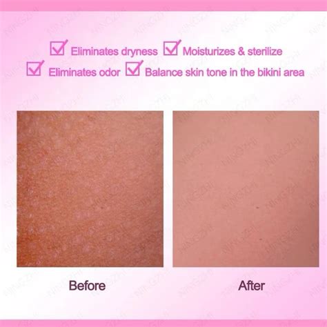 Olala V Area Rejuvenation Mask Brighten Dark Bikini Area Olala Gallery