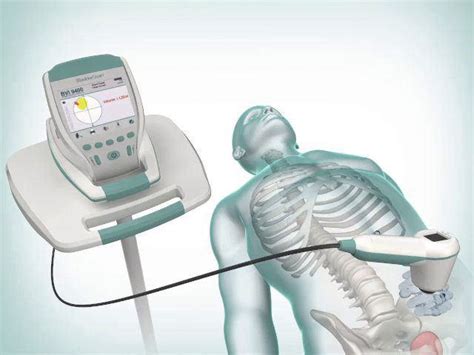 Calculs V Sicaux Steinberg Urologie Montr Al