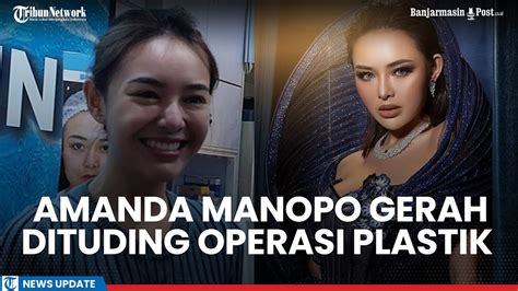 Karier Amanda Manopo Ikut Terdampak Gara Gara Tudingan Operasi Plastik