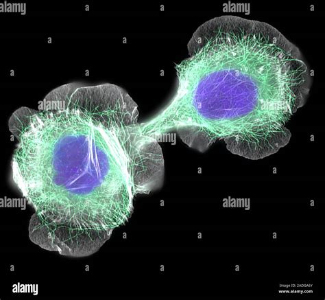 Cellules HaCaT La lumière de l immunofluorescence micrograph HaCaT