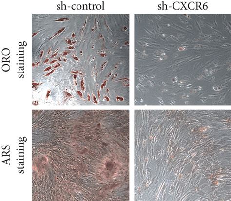 CXCR6 Knockdown By Small Hairpin RNA Technique A Quantitative CXCR6