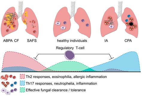 JoF Free Full Text The Multifaceted Role Of T Helper Responses In