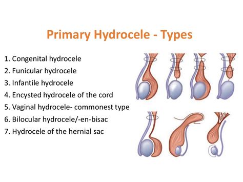 SCROTAL SWELLING