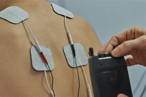 Transcutaneous Electrical Nerve Stimulation Tens A Canadian Primer