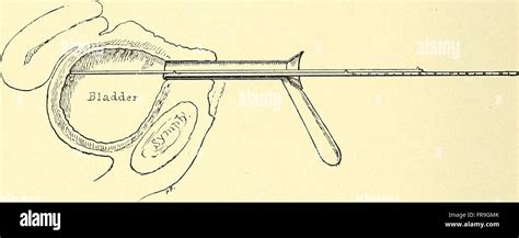 Operative gynecology - (1906 Stock Photo - Alamy