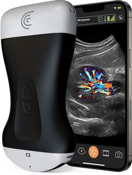 Best Handheld Ultrasound - Best Handheld Ultrasound
