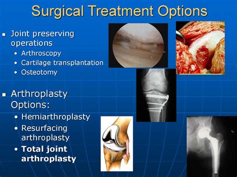 Modes Of Failure In Revision Hip And Knee Replacement Online Presentation