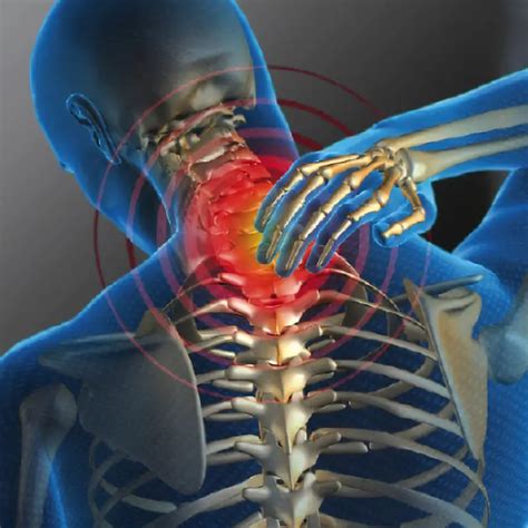 Douleur à la nuque et aux épaules Signification émotionnelle Lombafit