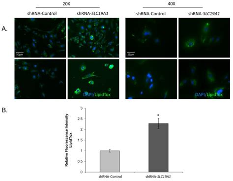 Lipid Droplet Accumulation In SLC19A1 Knockdown THLE2 Cells SLC19A1 KD