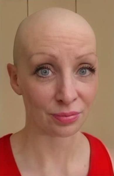 Bald Barefoot Bi Babe On Tumblr