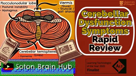 Cerebellar Dysfunction: Symptoms Rapid Review - YouTube