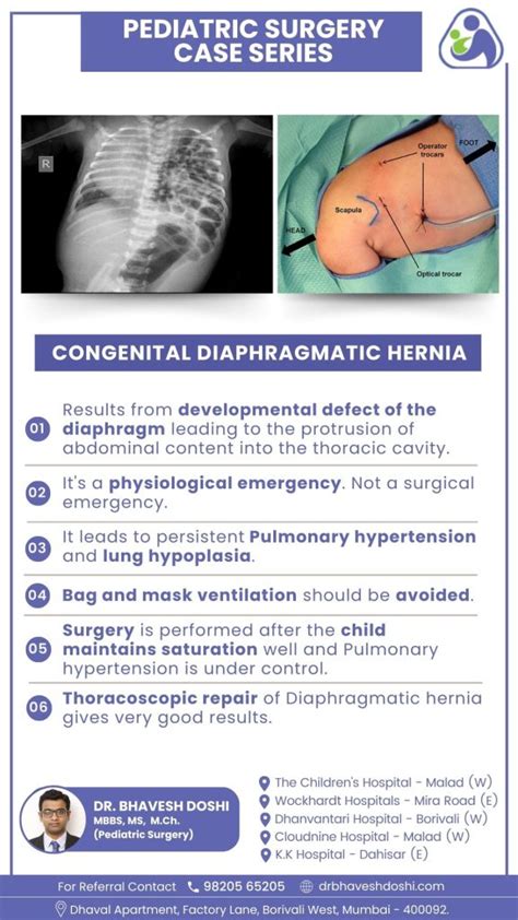 Congenital Diaphragmatic Hernia (CDH)