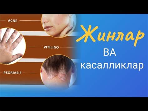 Жинлар ва касалликлар - YouTube
