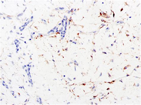 Immunohistochemistry Staining Of Vimentin × 20 Download Scientific