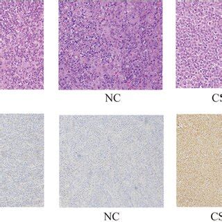 Pathological Comparison Of Transplanted Tumors In Nude Mice BC Blank