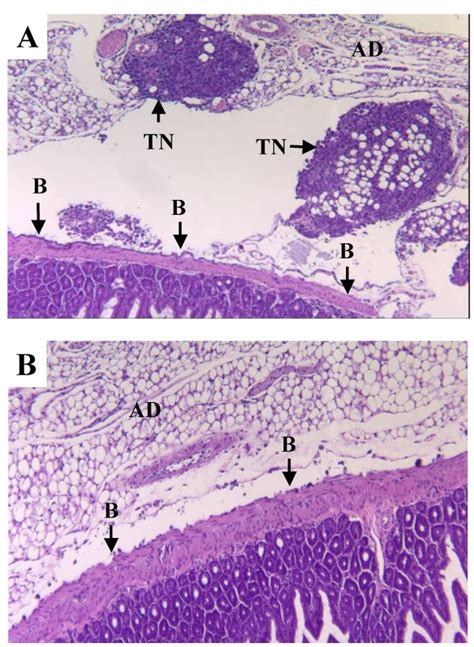 Mesenterio Histologia