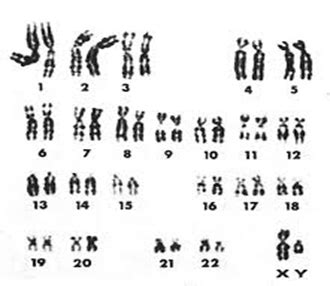 Sex Chromosome Inheritance Flashcards Quizlet