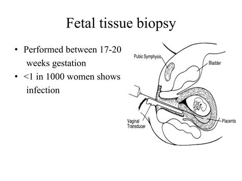 Prenatal diagnosis | PPT