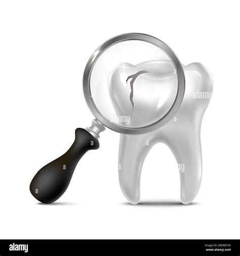 Realistic Vector Icon Illustration Dental Clinic Brocken Tooth With