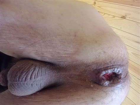 Anal Gaping And Double Penetration And Beer Bottle And Bedpo Nude Pics XHamster