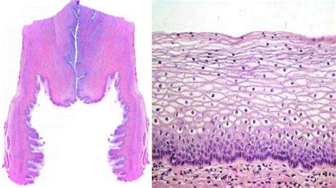 Histología del cérvix uterino y vagina