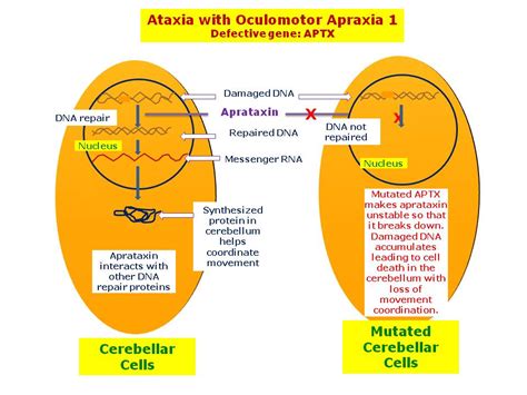 Ataxia And Apraxia Apraxia Speech Therapy Activities Central | Hot Sex ...