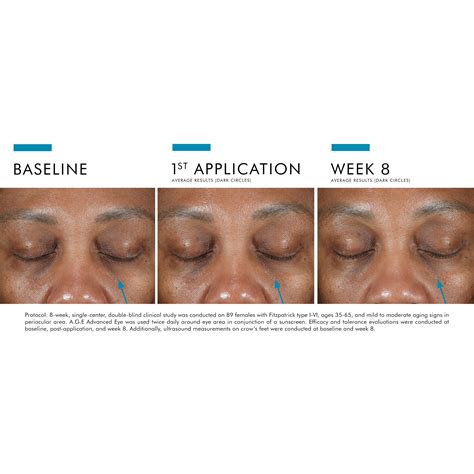 SkinCeuticals A.G.E. Advanced Eye - SF Wellness