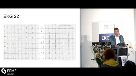 Grundlagen Der EKG Befundung 3D Anatomie Des Herzens CME Video