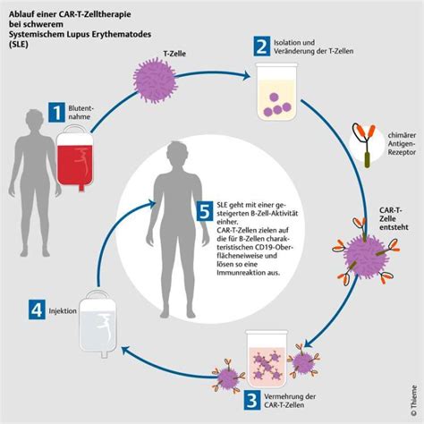 Durchbruch Bei Der Lupus Behandlung Innovations Report