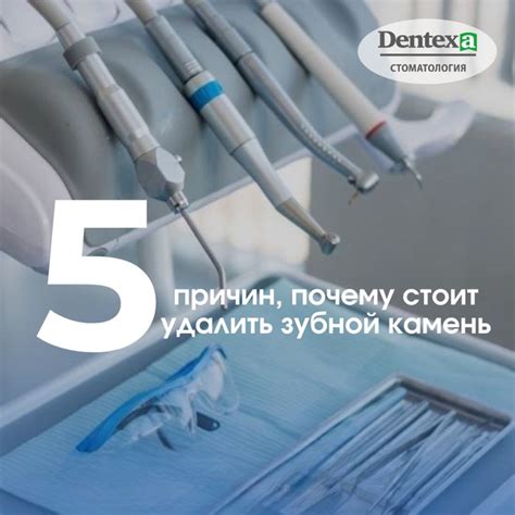 5 причин удалить зубной камень! Зубной камень — это отвердевший налет ...