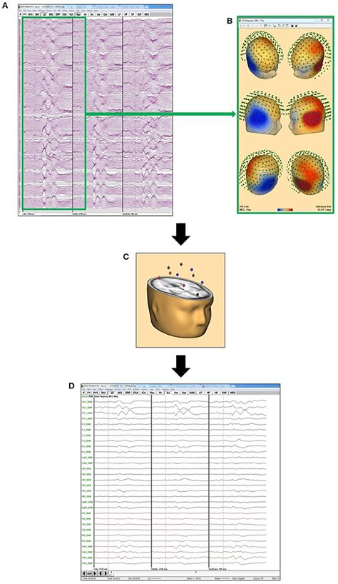 Frontiers Neuronal Correlates Of Product Feature Attractiveness