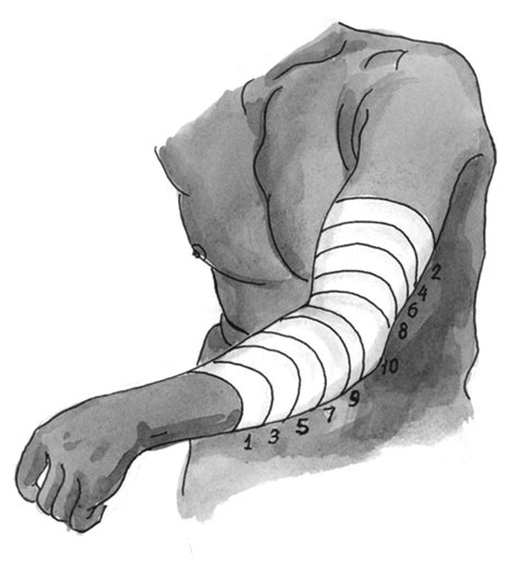 Повязки и современные перевязочные материалы в медицине. Классификация ...