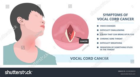 24 Otolaryngology Botox Images Stock Photos Vectors Shutterstock