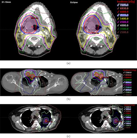 Representative Dose Distributions For The Reflexion X Mm Jaw Left