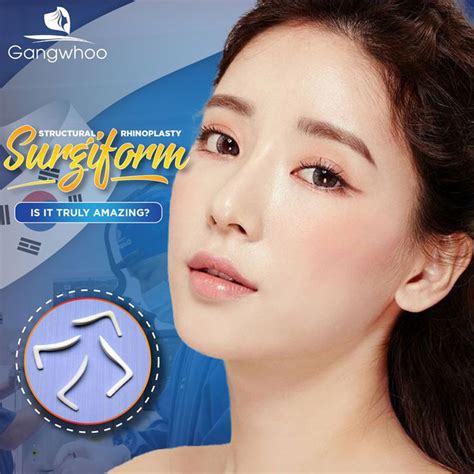 Surorm Rhinoplasty The Best Nose Shape Of A Model Gangwhoo