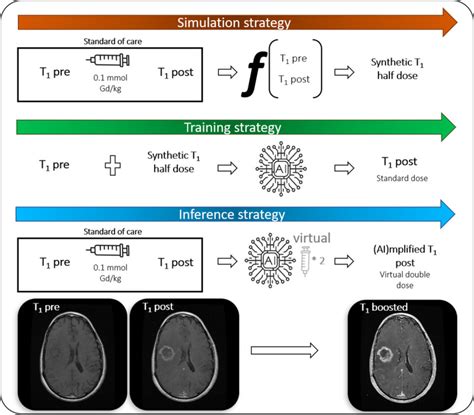 Amplifying The Effects Of Contrast Agents On Magnetic Resonance Images