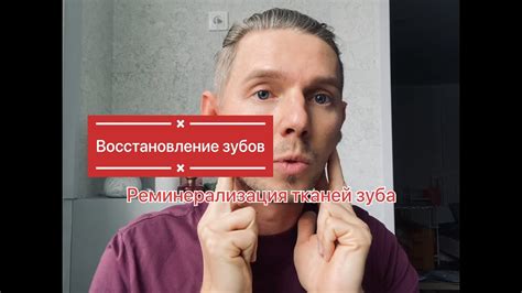 Реминерализация зуба. Или восстановление зубов - эстественный и ...