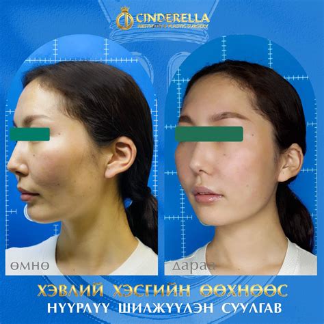 Cinderella plastic surgery / Синдерелла мэс заслын эмнэлэг/ - Home