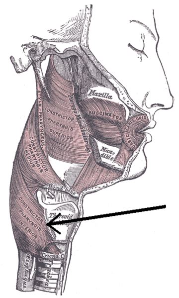 Retrograde Cricopharyngeus Dysfunction (R-CPD) - almostadoctor