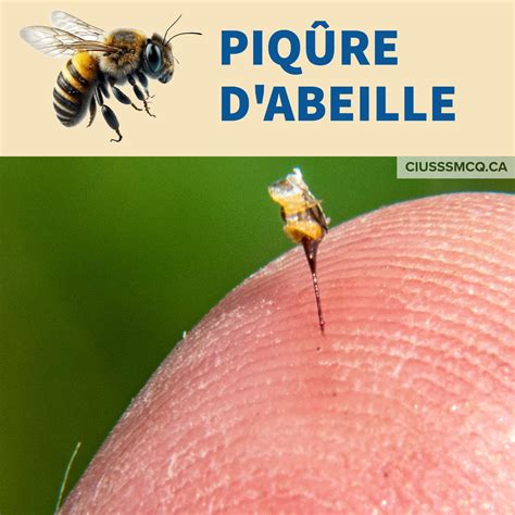 Piqûre d insecte Identifier les types de piqûres Abeille guêpe