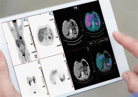 Molecular Imaging - AGFA HealthCare