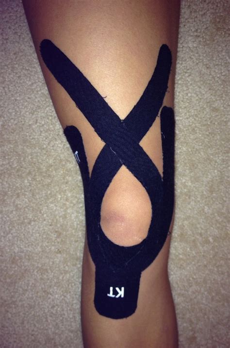 18 best Patellar Tracking Disorder images on Pinterest | Workouts ...