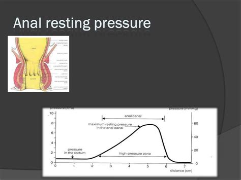 PPT Anal Fissure What When Why PowerPoint Presentation Free