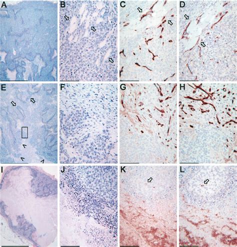 Xenograft experiments in nude mice Animals n ϭ per group were Download Scientific Diagram