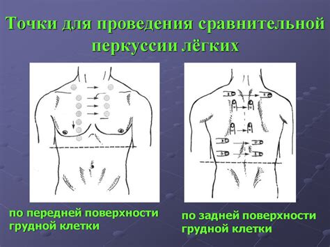 Пальпация перкуссия аускультация при стенокардии - фото презентация