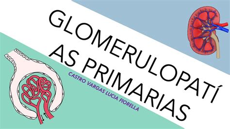 GLOMERULOPATÍAS PRIMARIAS NEFROLOGÍA Mis apuntes de Medicina uDocz