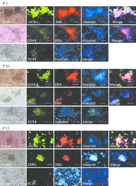 Immunocytochemical Characterization Of Cultured Cells At Passages P